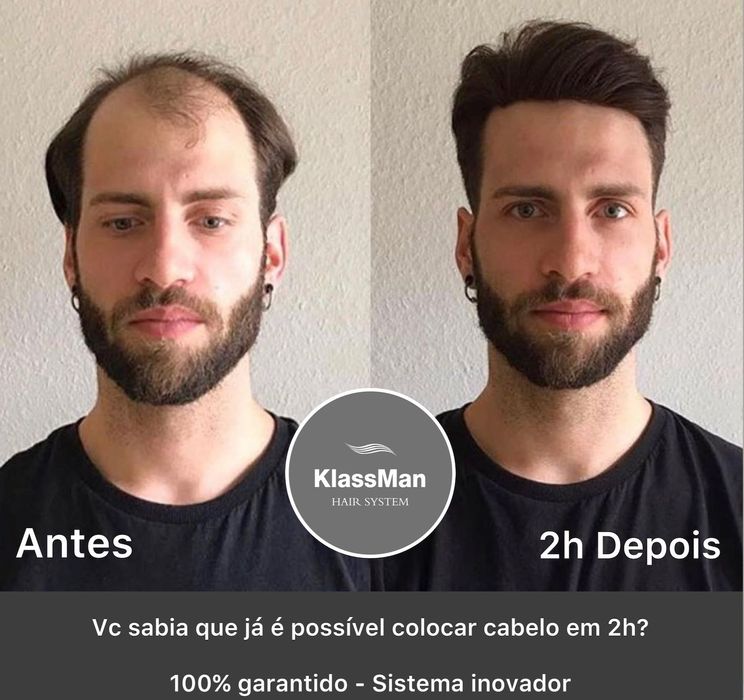 Nova Clinica KlassMan Lisboa Metro-Telheiras 1m. Porto Metro-Dragão 1m