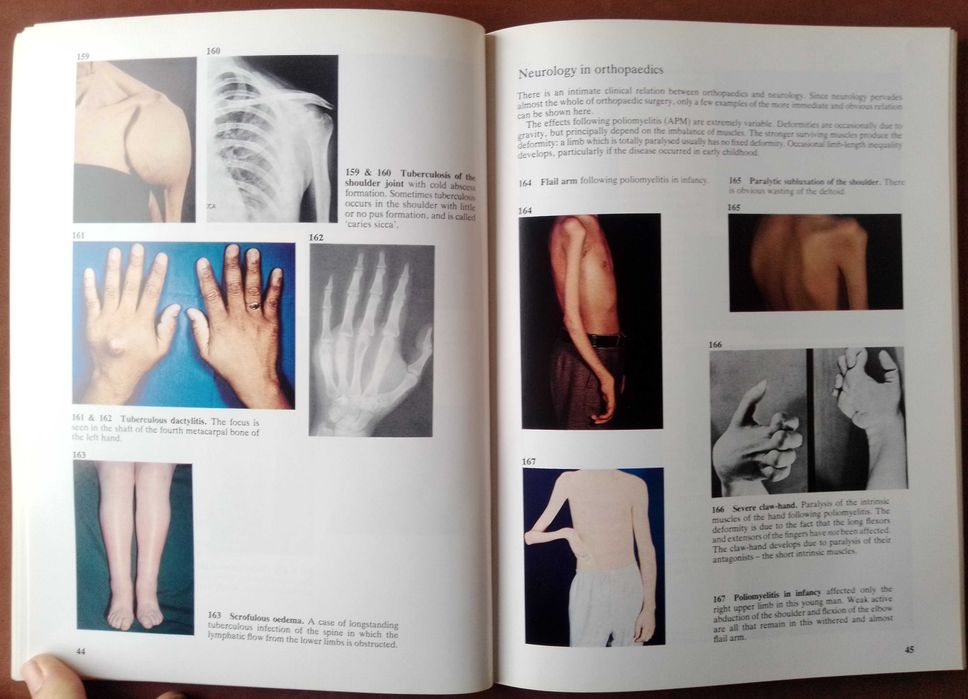 A Colour Atlas of Clinical Orthopaedics