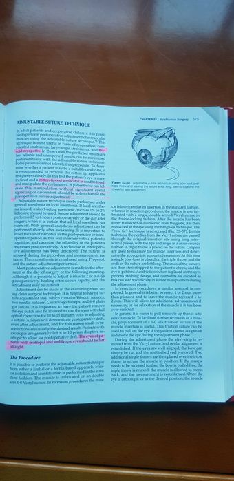 Ophthalmic surgery principles and practice george l. Spaeth