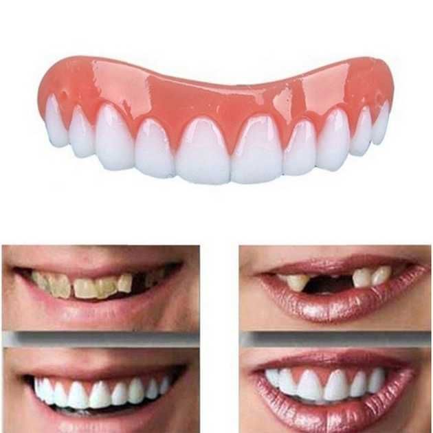 Виниры съемные для зубов верхней челюсти Perfect Smile Veneers