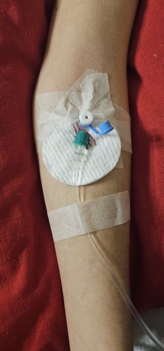 Kroplówki witaminowe, chelatacja, wit C – Poznań i okolice