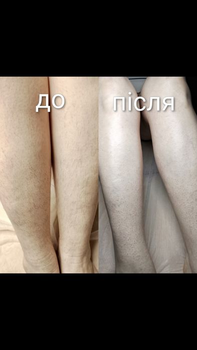 Воскова депіляція