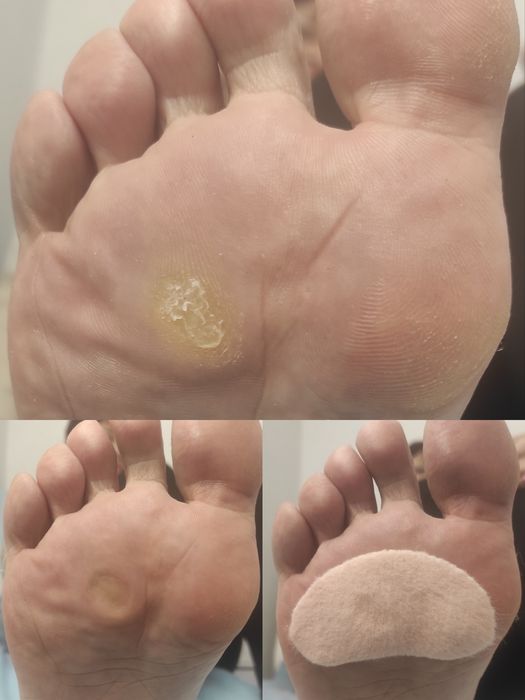 Подолог. Послуги подолога, медичний педикюр,  естетичний педикюр