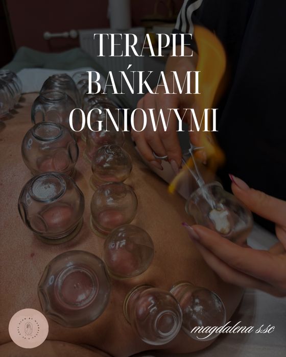 Terapia Bańkami ogniowymi - DOJAZD DO DOMU