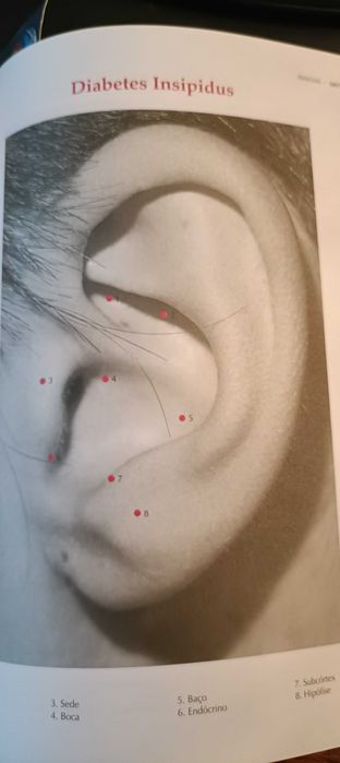 Livro acupuntura laser