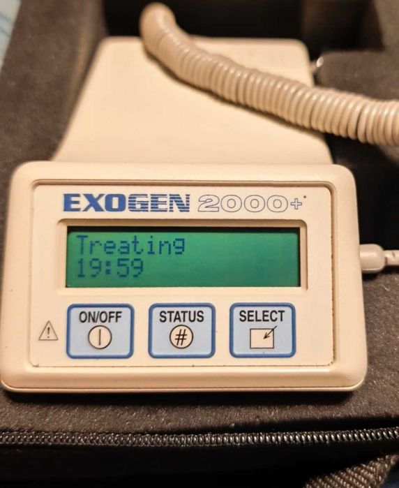 Exogen 2000+ przyspiesza gojenie złamania