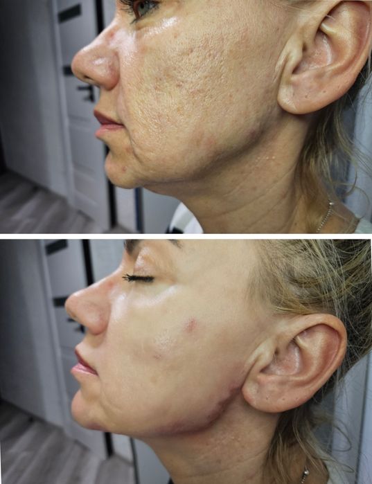 Mega promocja!Usta ,btx,Stymulatory, nici