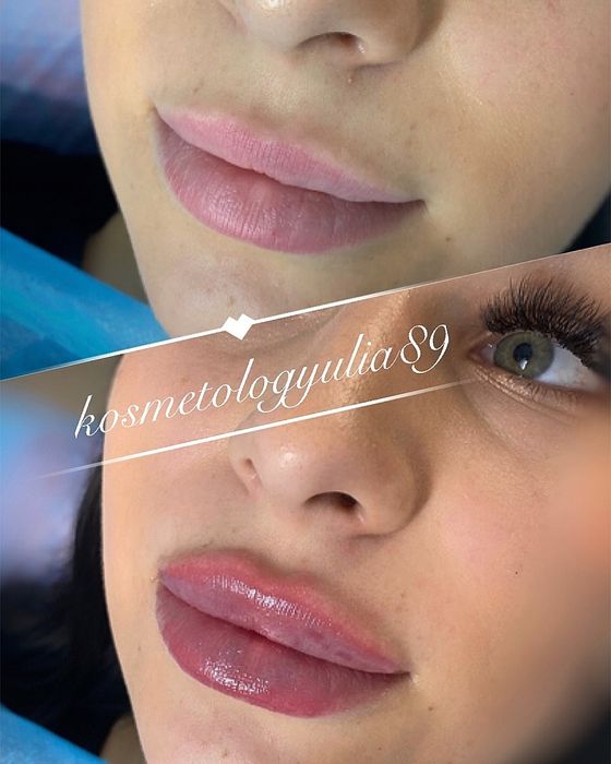 Увеличение губ от 2300 грн Sardenya Deep