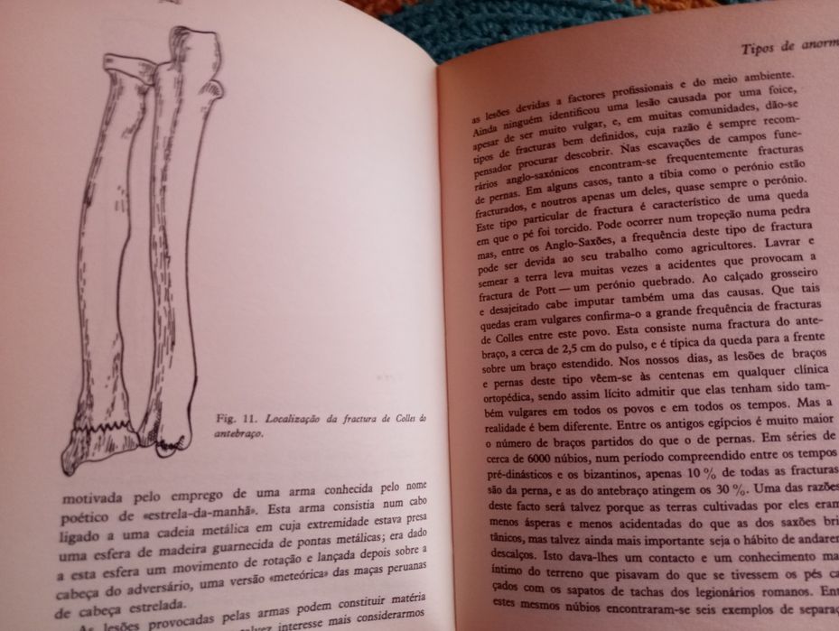 Calvin Wells - Ossos, corpos e doenças