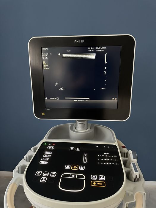 Ультразвуковий апарат Philips Sparq 2014р 3 датчика, УЗИ УЗД КАРДІО