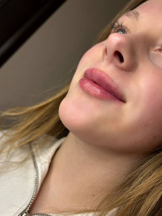 Нужны модельки на Губки ,Ботокс ,Full Face