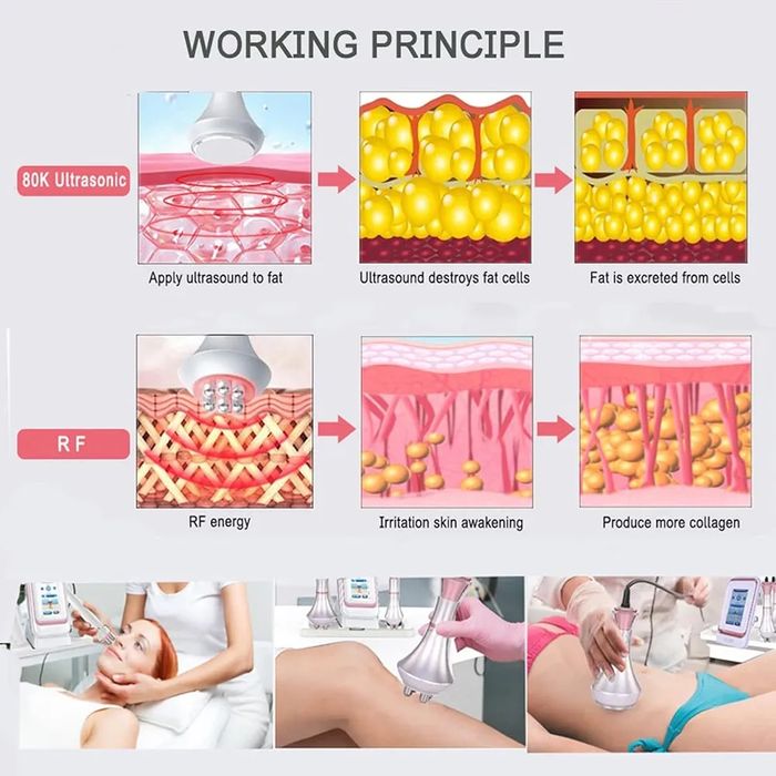 Аппарат ультразвуковой кавитации OSMARI 80K, аппарат 3-в-1 для коррекц