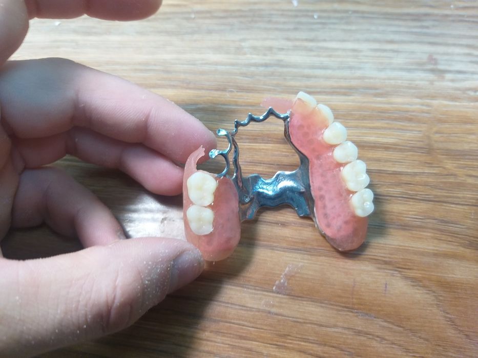 Зубний технік. Зуботехнічна Лабораторія  "Dental LAB"