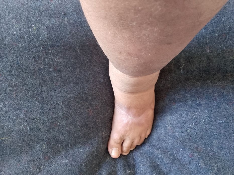 Требуется помощь в лечении