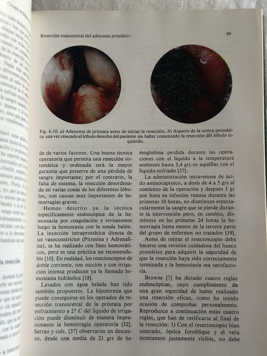 Cirugia Urologica Endoscopica de L. Cifuentes Delatte