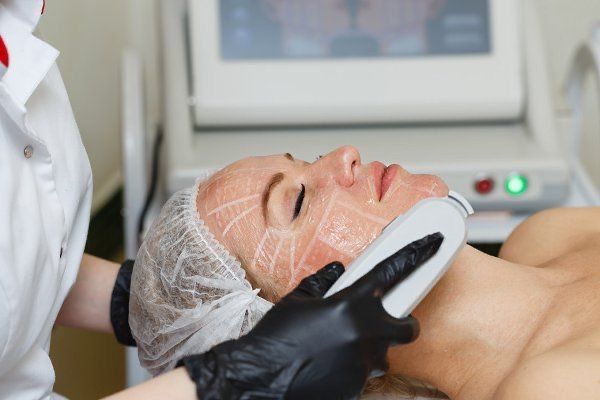HIFU Facial    pontinha