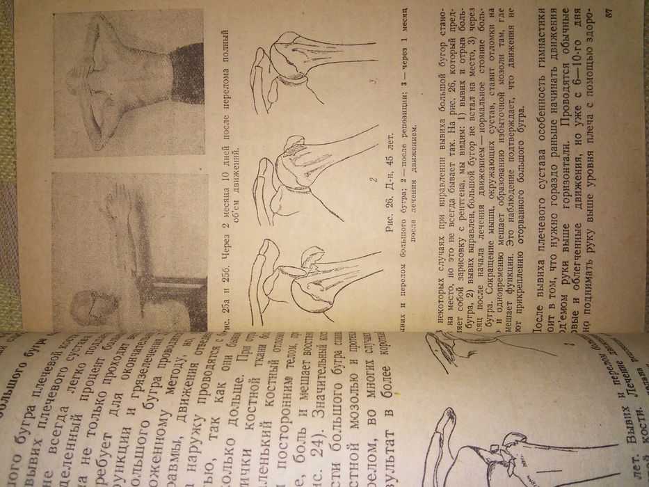 Древинг Лечебная физкультура в травматологии 1942