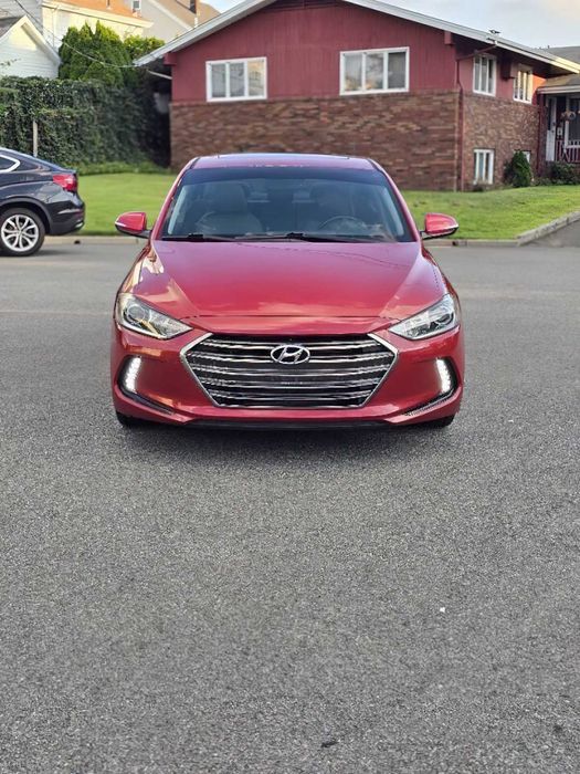 Hyundai Elantra      2017