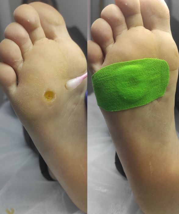 Подолог. Послуги подолога, медичний педикюр,  естетичний педикюр