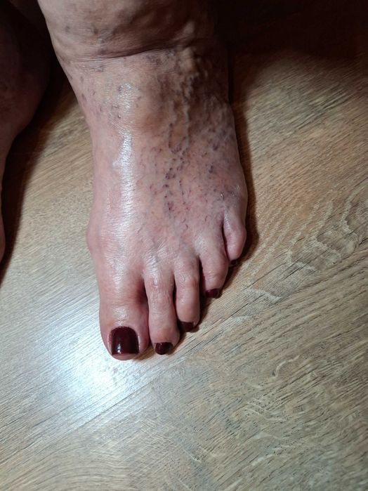 Szukam modelek na manicure i pedicure