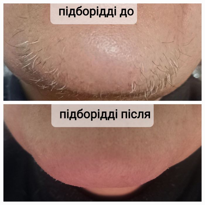 .ЖІНОЧА ВОСКОВА депіляція, Лівий берег. Чернігівська- Лісова. Працюю в