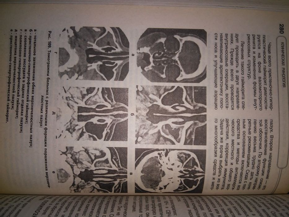 Пискунов Клиническая ринология. 2002