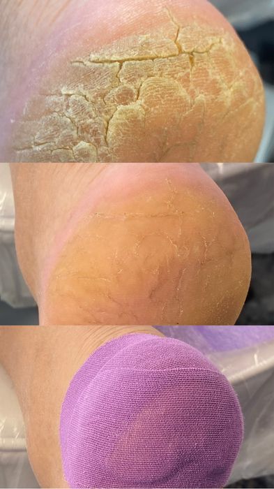 Подолог, маникюр, педикюр Каменское