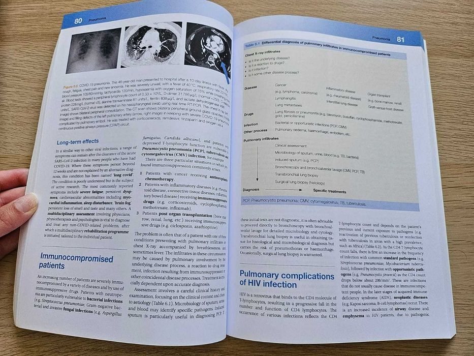 Respiratory Medicine (portes grátis)