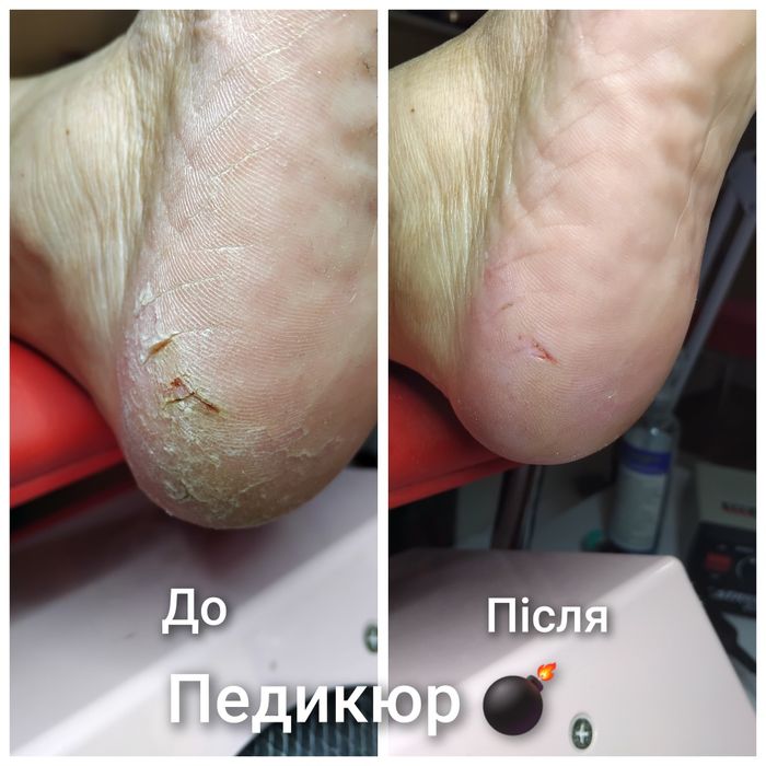 Манікюр, педикюр, нарощення