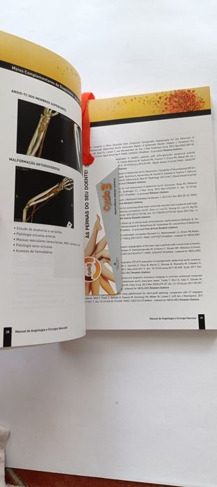 Livro NOVO Medicina Manual Angiologia e Cirurgia Vasc PORTES INCLUÍDOS