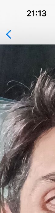 Prótese capilar cabelo 100%narural