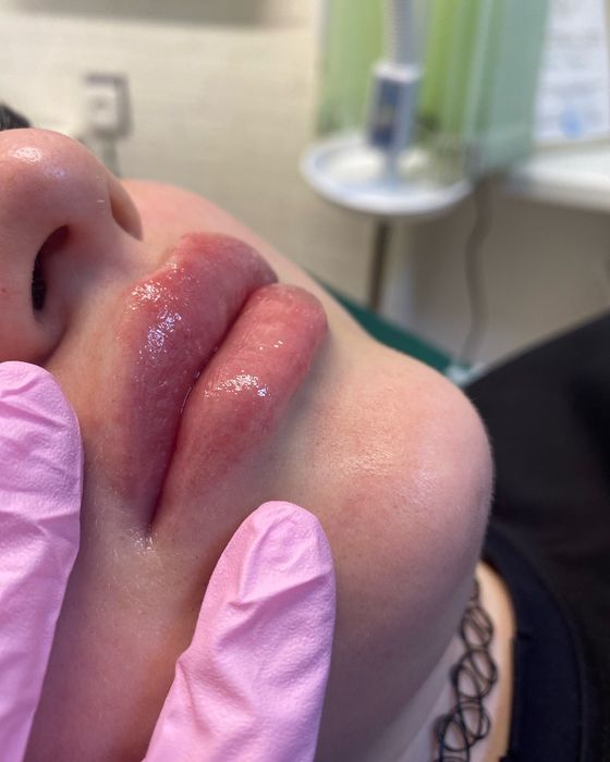 Ищу девочек которые хотят сочные губки !Оплата только за препарат !