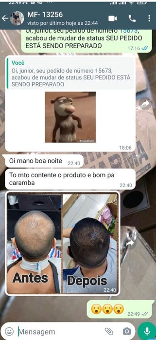 Minoxidil - original