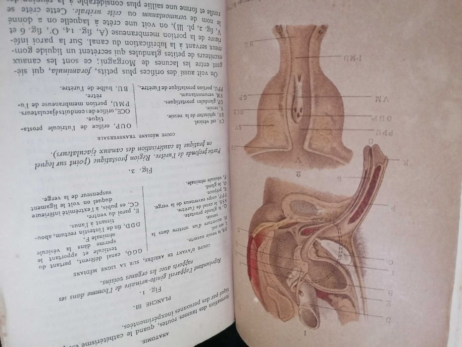 Traité Pratique des Maladies des Voies Urinaires, par Jozan Pére ,1884