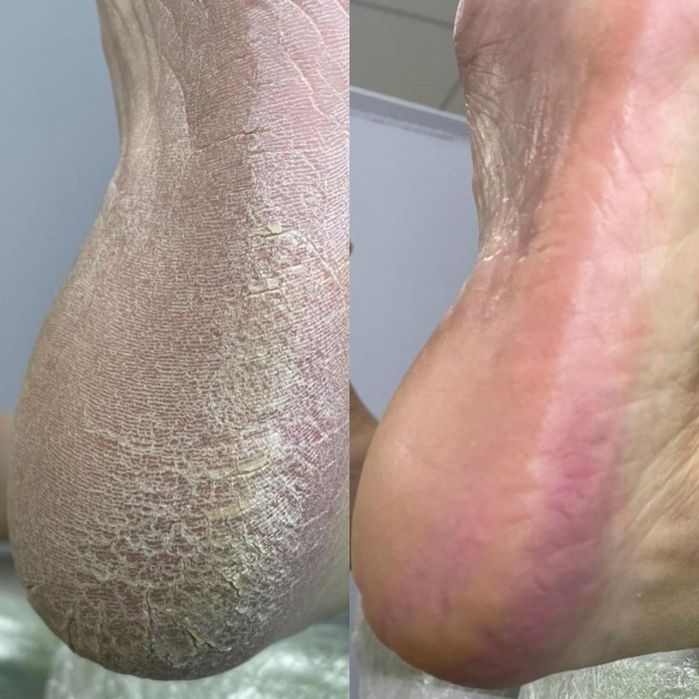 Подолог. Послуги подолога, медичний педикюр,  естетичний педикюр