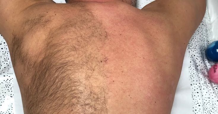 Depilacja męska różna