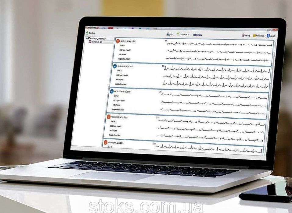 Монитор ЭКГ Wellue