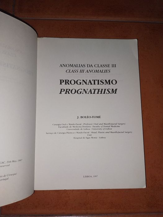 Anomalias de Classe III Prognatismo - Medicina  Dentária