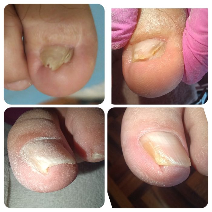 Apoio domiciliário e pedicure ao domicílio