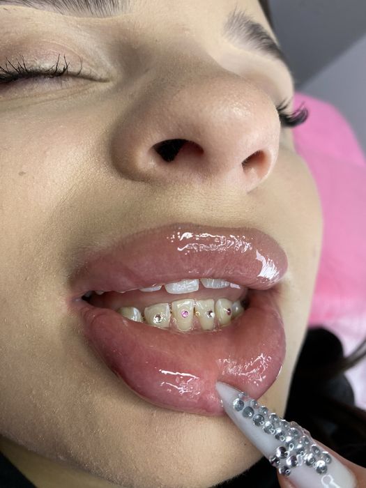Toothgems dla pań/panów