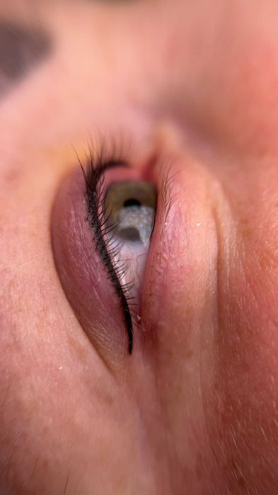 Перманент ГУБЫ. ВЕКИ. БРОВИ. Удаление. 2-ст ФОНТАНА