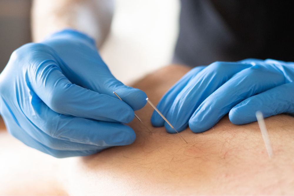 Fizjoterapia sportowa z dojazdem - Kraków