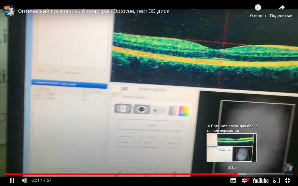 Офтальмологический томограф OPTOvue RTVUE-100