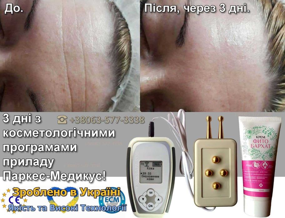 Щоденна підтримка здоров'я Семейный лечебный прибор Паркес-Медикус 1400 програм Мини-доктор