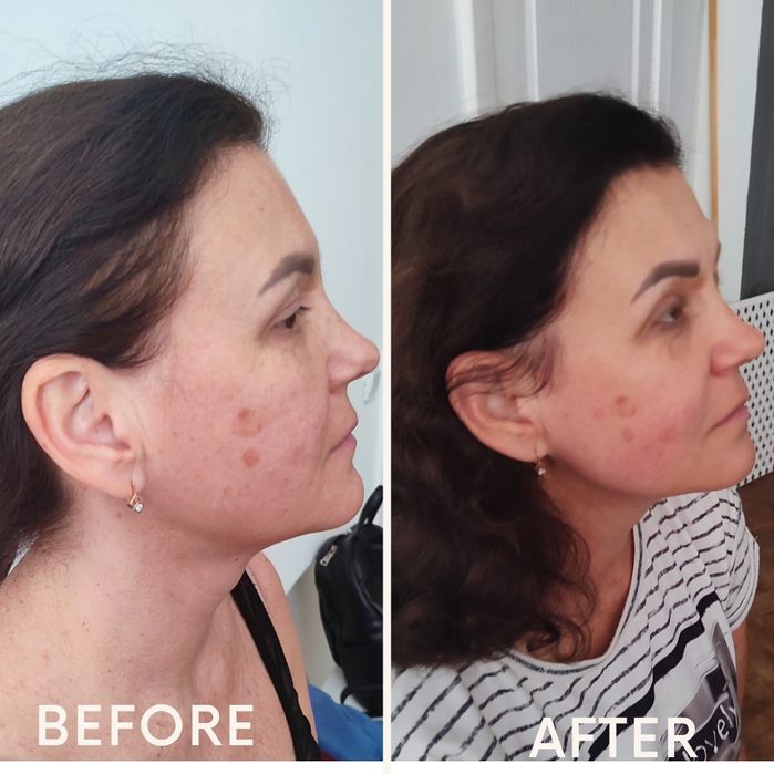 Скульптуруючий ліфтингово-дренажний масаж обличчя