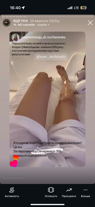 Лазерна епіляція