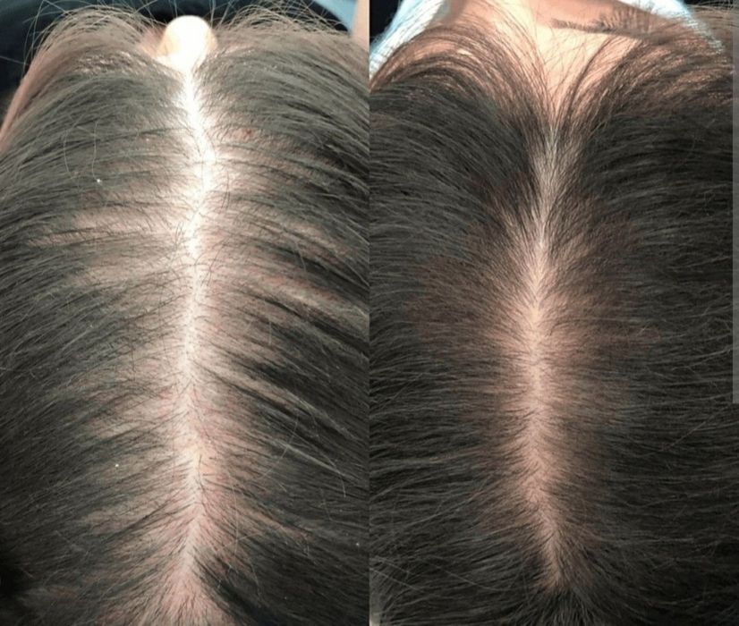 Косметолог (ботокс, контурная пластика губ,мезо, біоревіталізація)