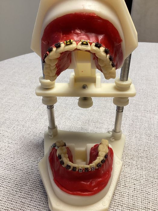 Kleszcze ortodontyczne -zestaw do szkoleń praktycznych.