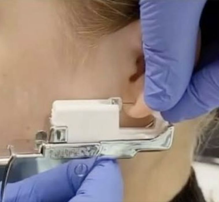 Прокол ушей без шума