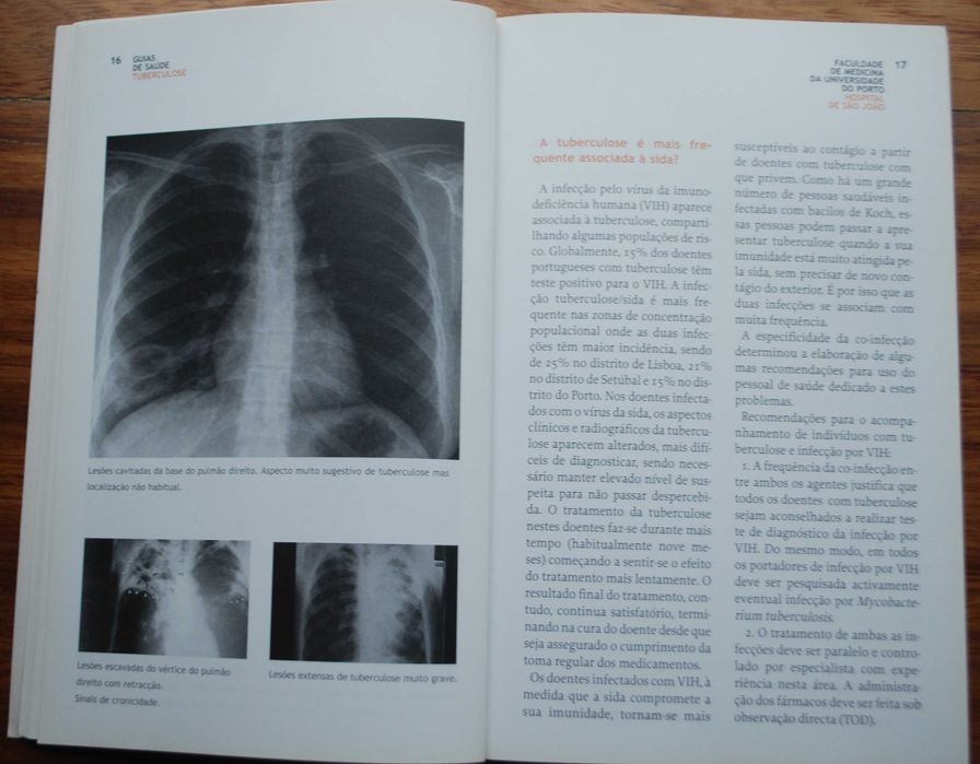 Guias de Saúde Tabagismo / Tuberculose